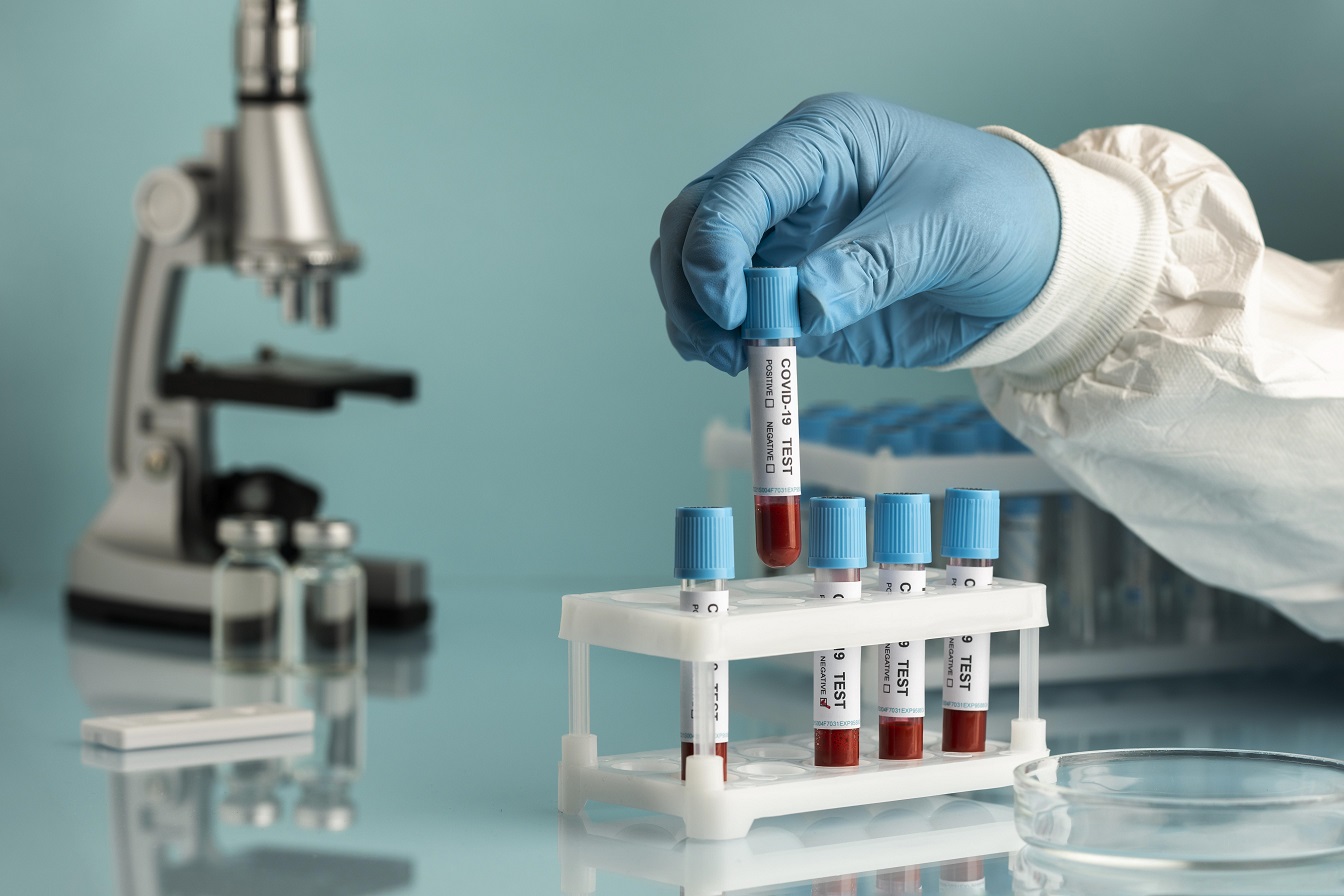 Lab Tests